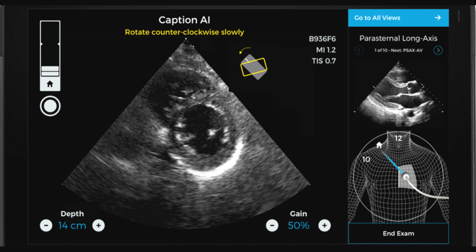 Caption Health echocardiogram